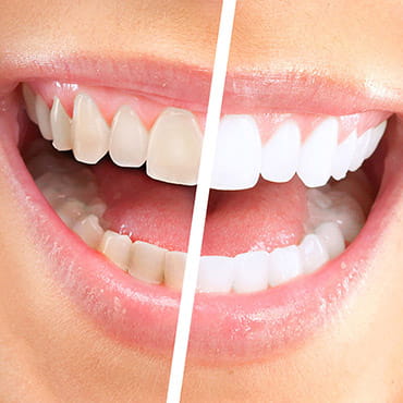 southside dental services cosmetic dentistry background image
