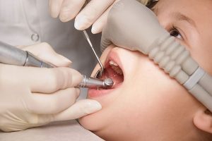 southside dental services nitrous oxide sedation background image